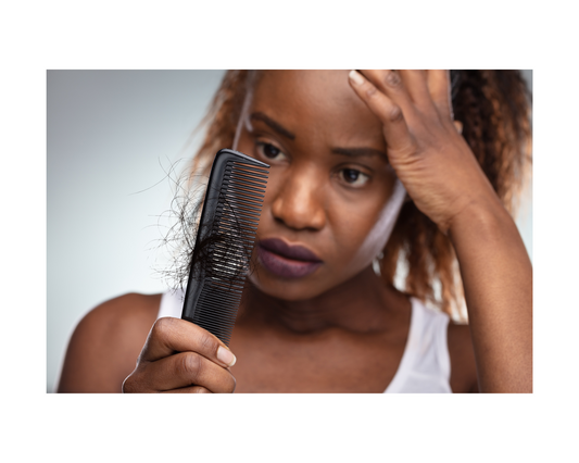 image of black woman with hair loss and hair thinning needs scalp treatment